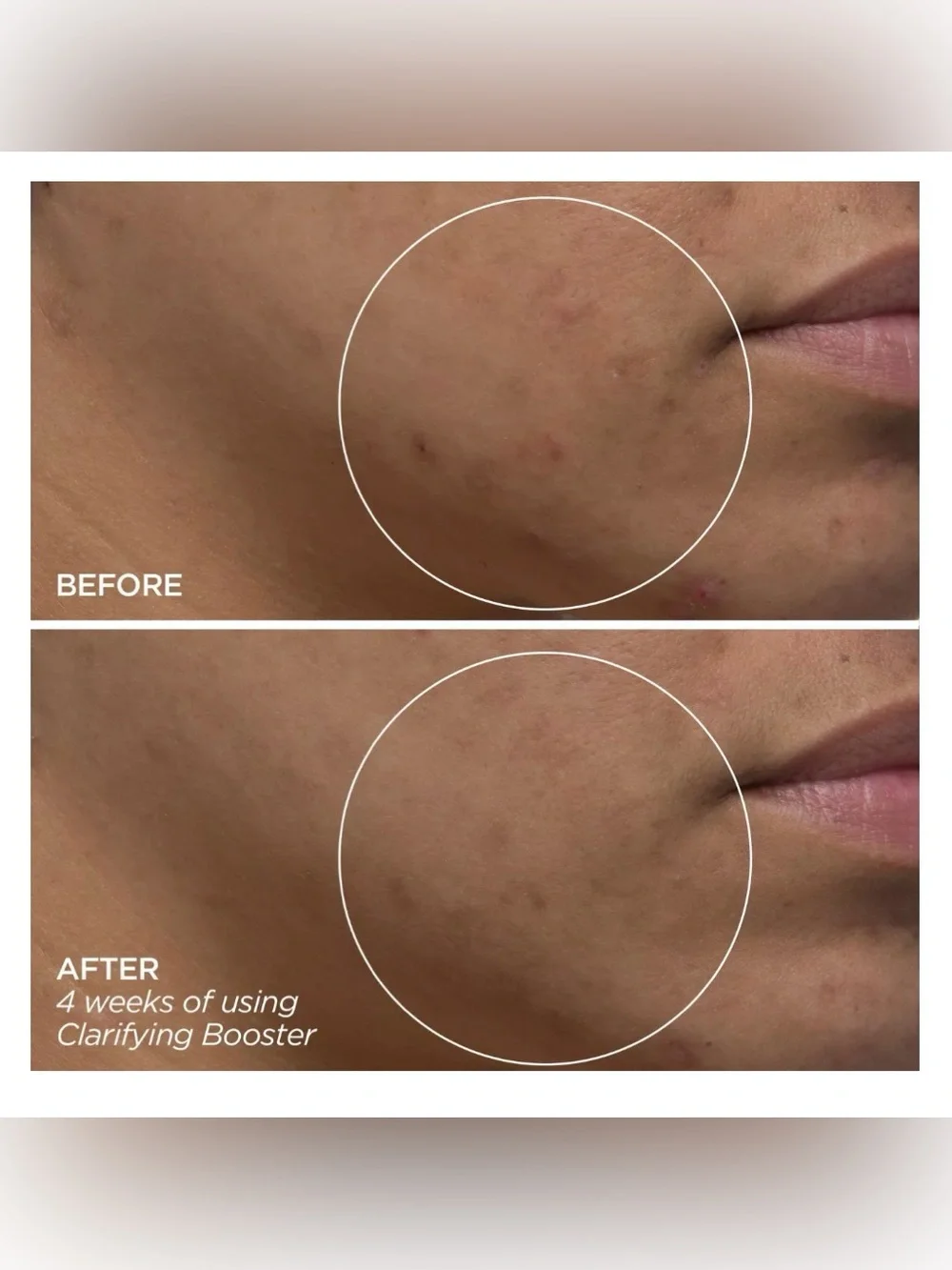 BEAUTYBIO Clarifying Booster - Salicylic Acid Treatment Serum